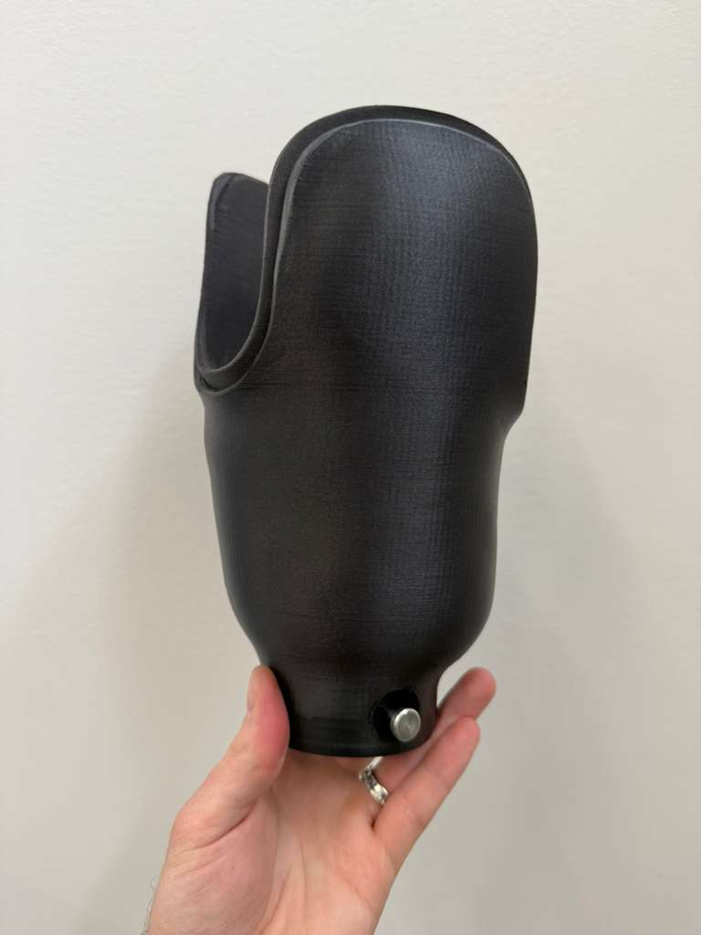 Prosthetic Socket being 3D scanned