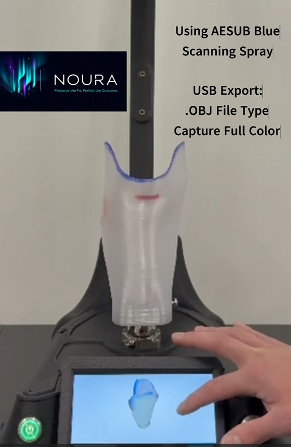 Prosthetic Socket being 3D scanned
