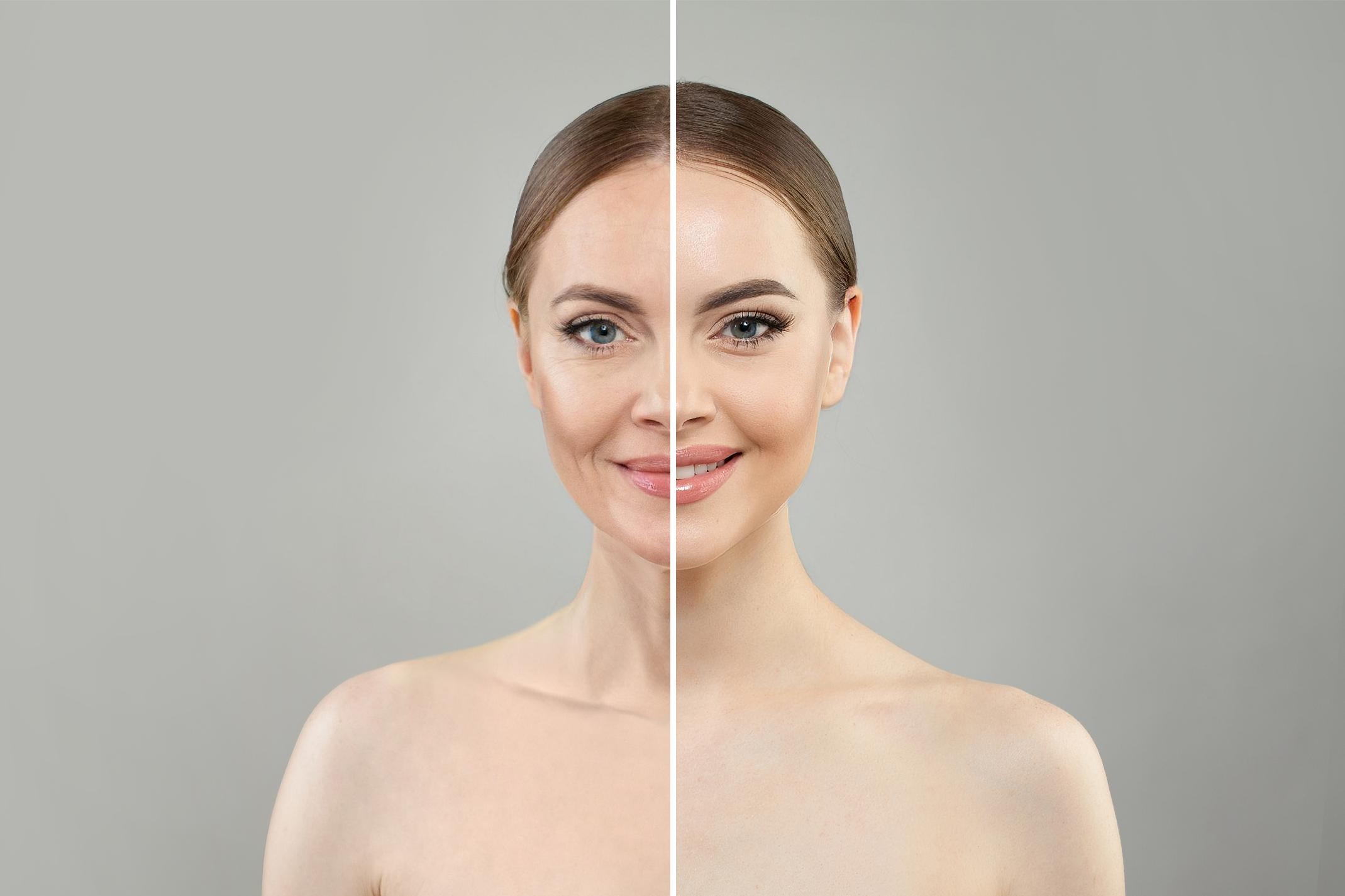 Split image of woman's face showing aged skin on left and smooth youthful skin on right side.