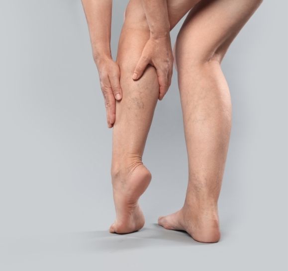 Opciones de tratamiento para el lipedema: guía comparativa por etapa