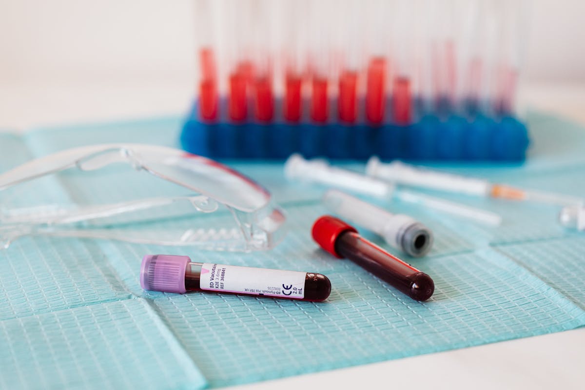 Full vials of blood arranged near various medical equipment in a laboratory