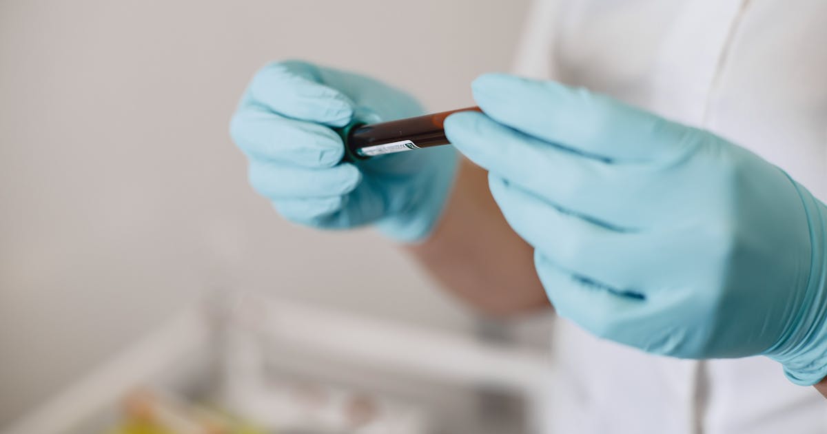 Close-up of a lab technician holding a blood sample vial in a medical laboratory setting