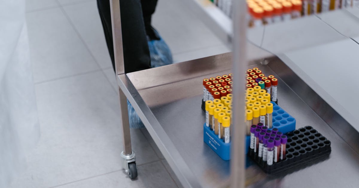 Close-up of blood sample vials organized in a laboratory setting
