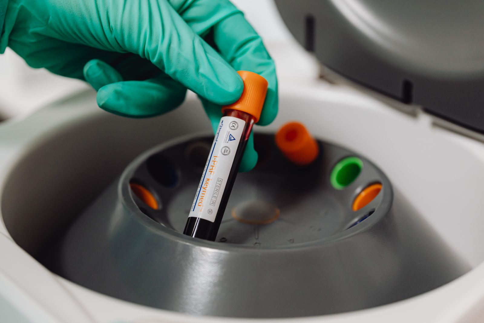 A gloved clinician placing a blood sample tube into a centrifuge