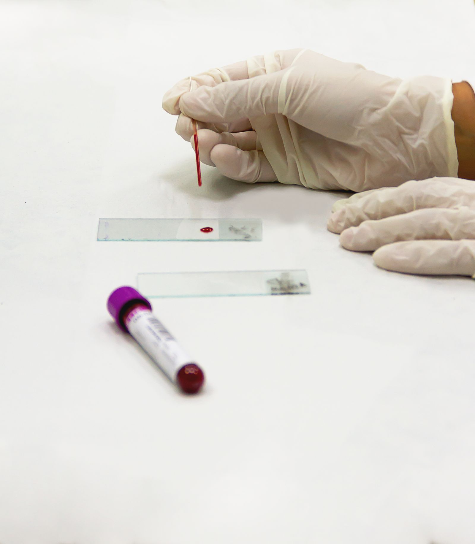 A gloved lab technician preparing a blood sample beside a labelled collection tube