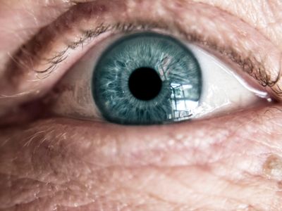 Eye Floaters: Why Most Are Harmless, and the 3 Signs That Are Not