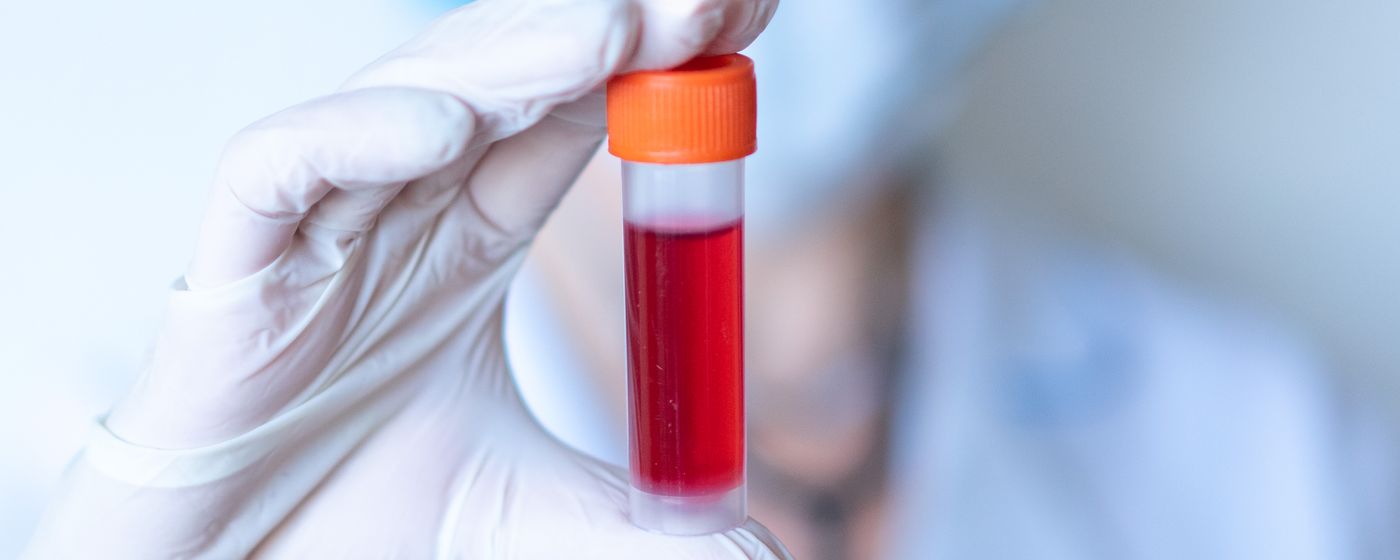 A gloved healthcare worker holding a blood sample vial in a laboratory.