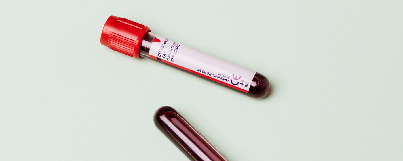 Two blood collection tubes lying on a pale surface