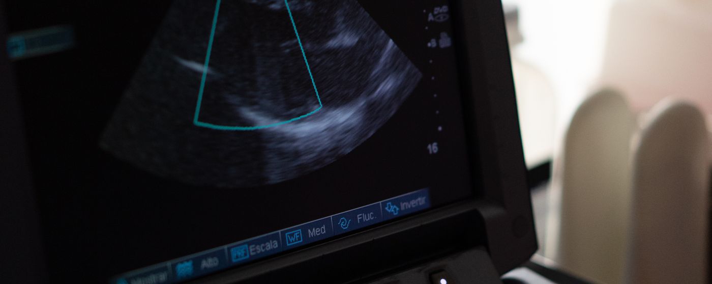 An ultrasound machine screen displaying a live scan during an examination