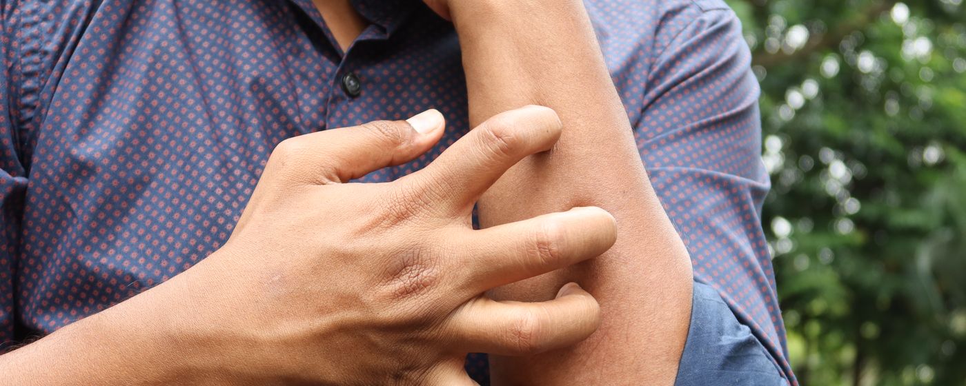 A man in a blue polo shirt scratching his forearm outdoors