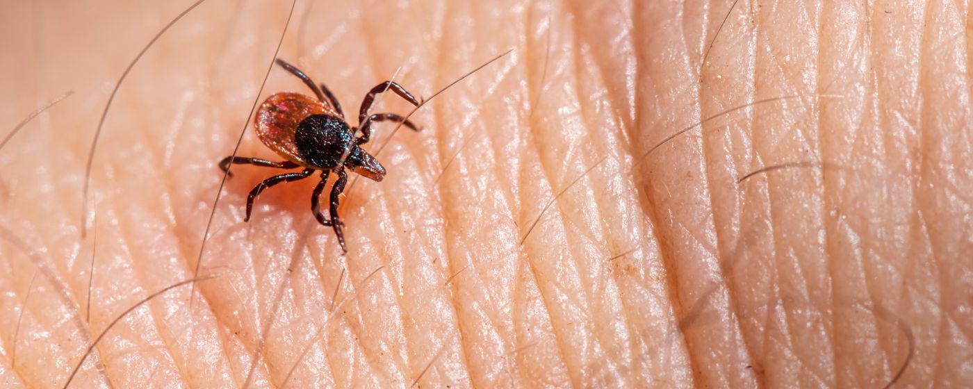 Close-up of a tick crawling on a person's skin