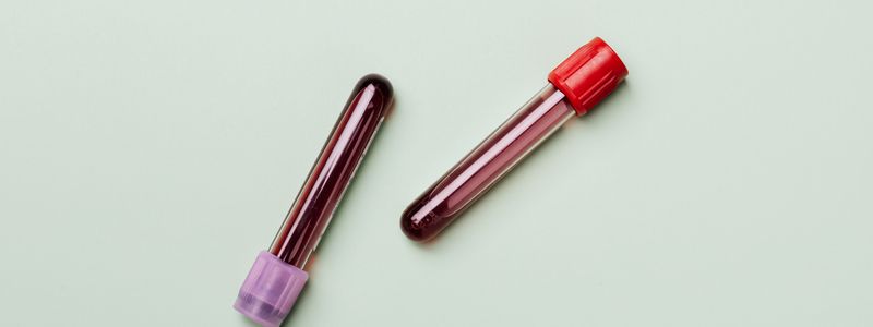 Two blood sample tubes with colored caps resting on a pale green background