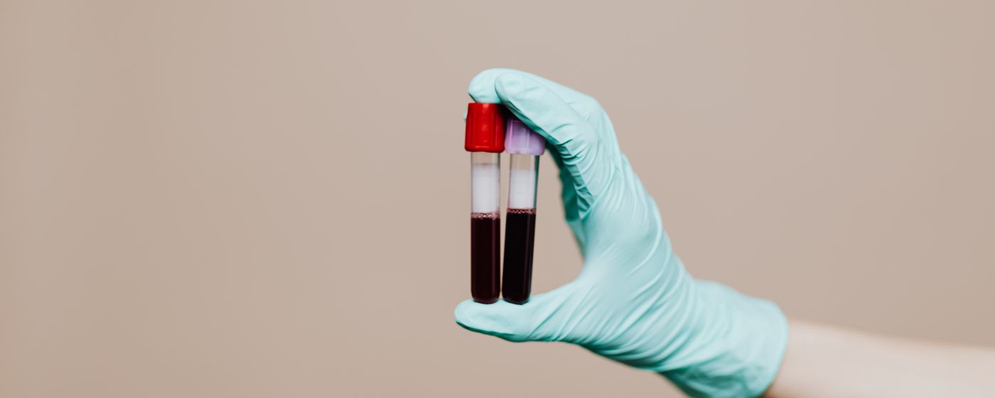 A gloved hand holding two blood sample tubes against a plain background