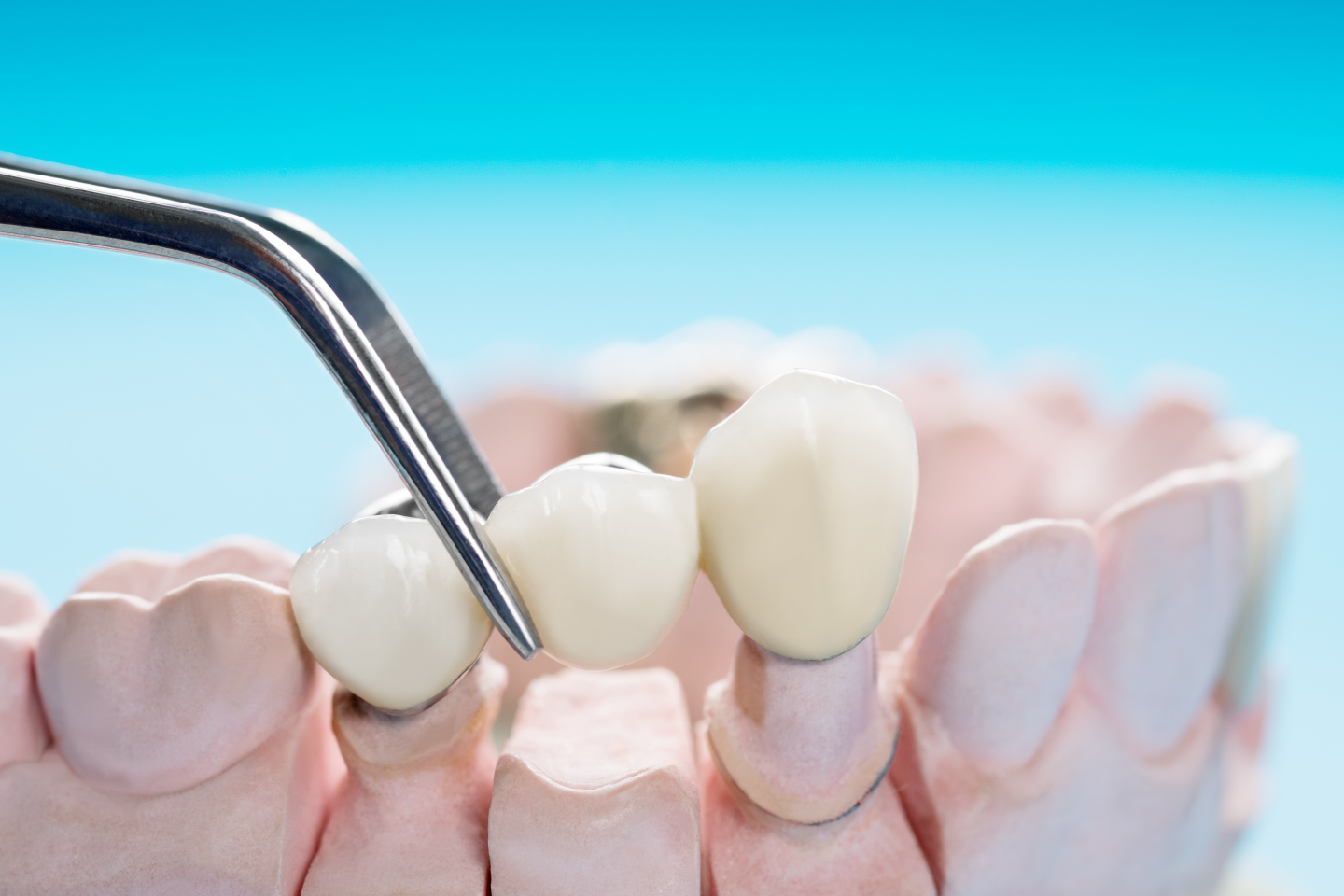 Comprehensive dental care services Brooklyn NY