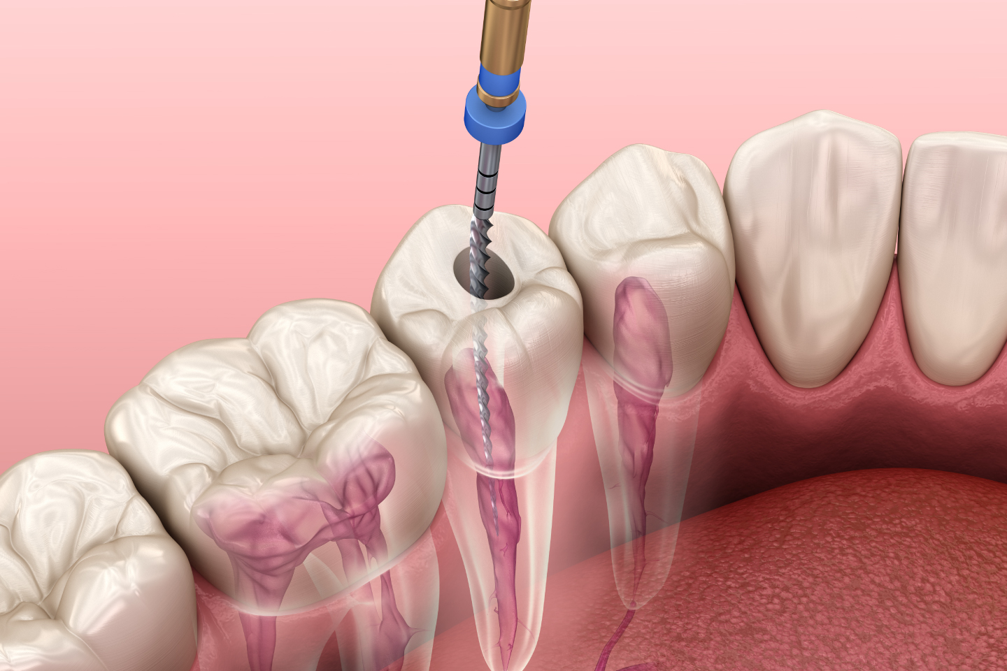 Brooklyn dental office Canarsie Dental Specialist