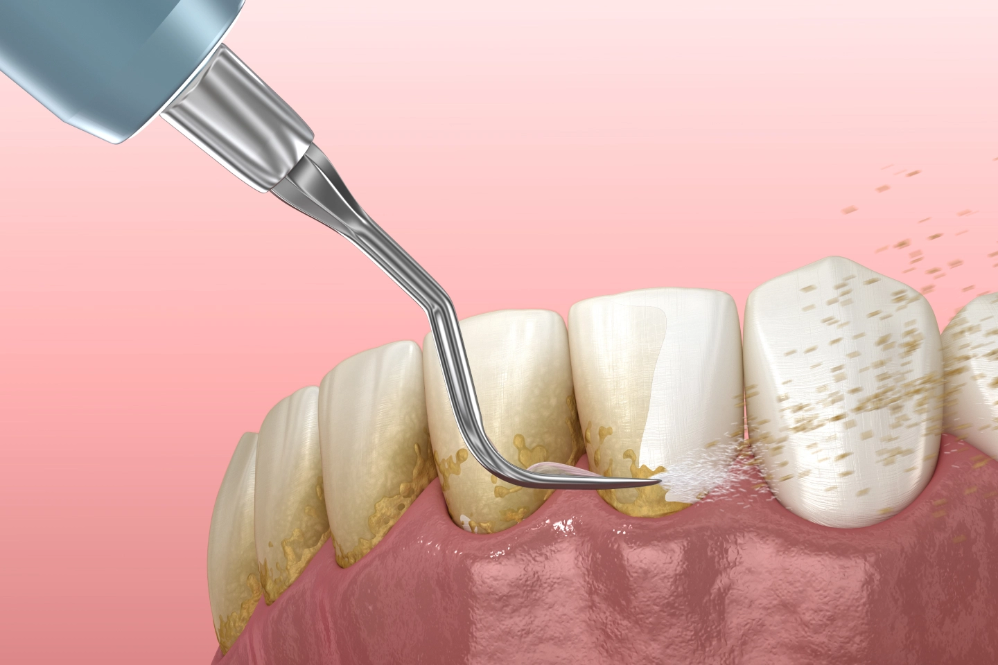 Comprehensive dental care services Brooklyn NY