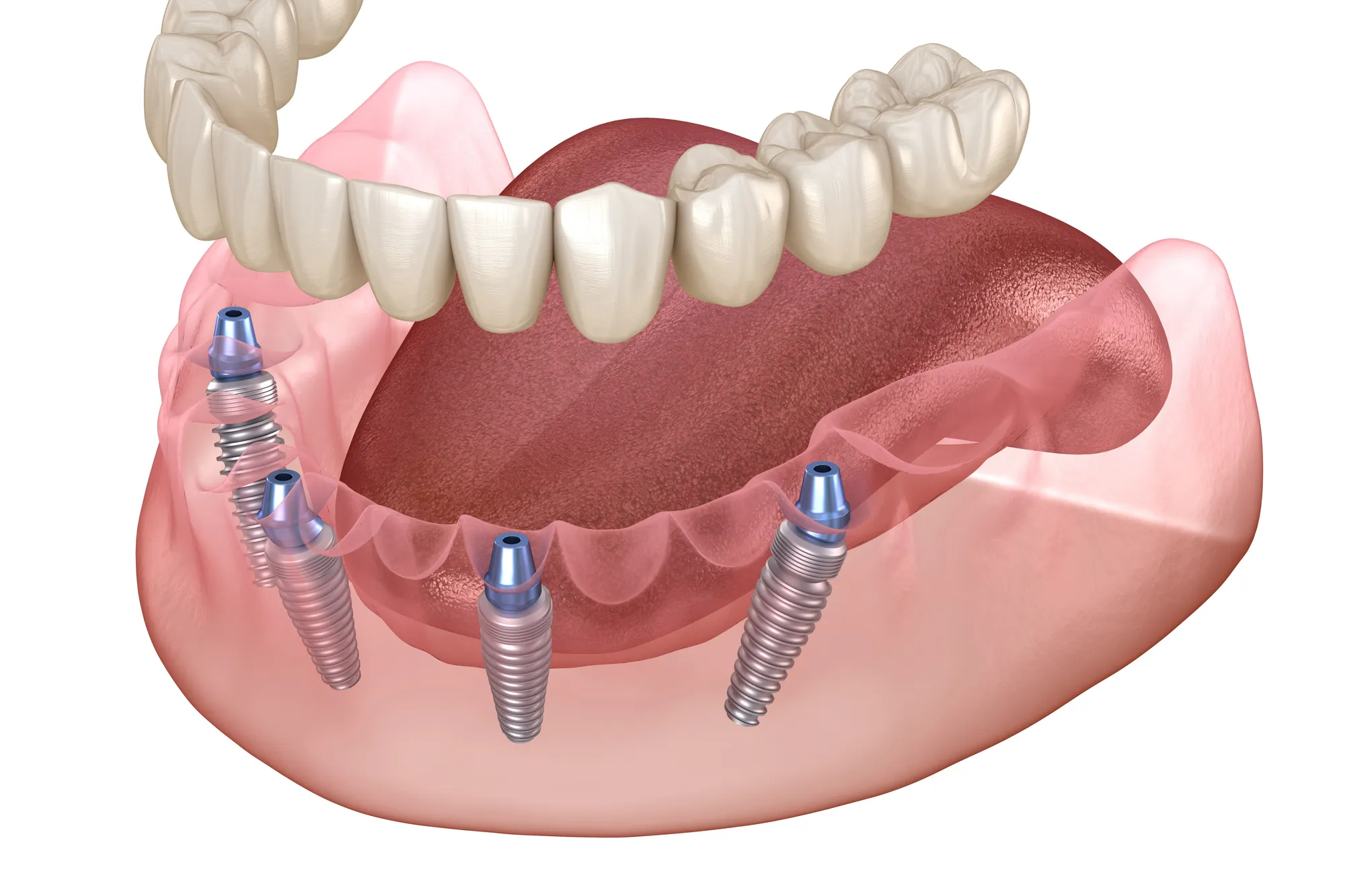 Comprehensive dental care services Brooklyn NY