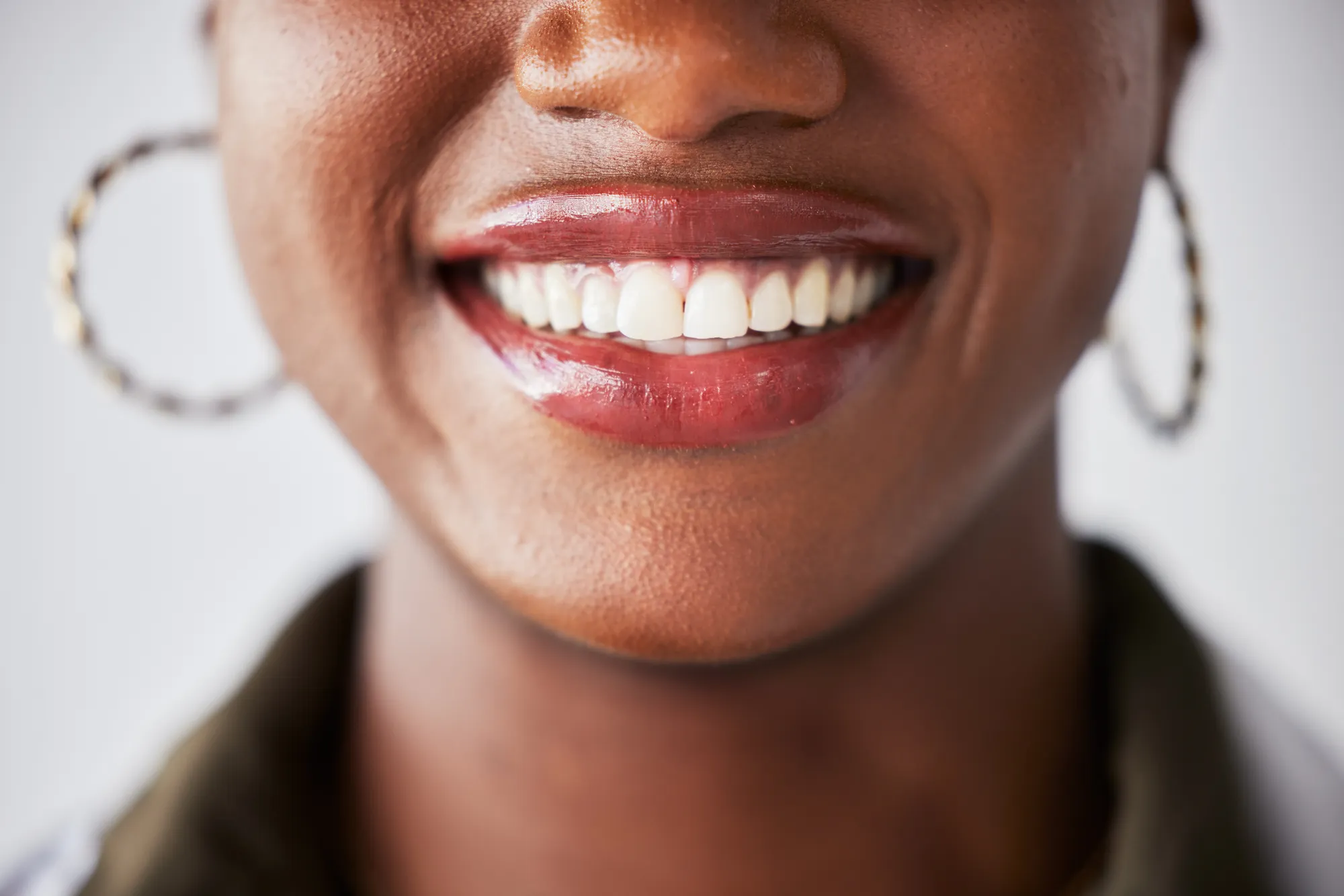 Dental specialists team at Canarsie Dental Brooklyn