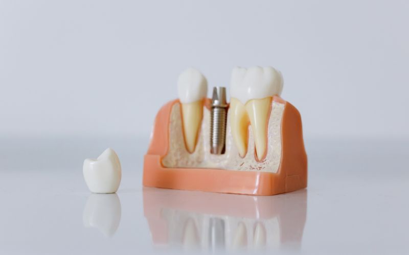 Oral health articles from Canarsie Dental Specialist