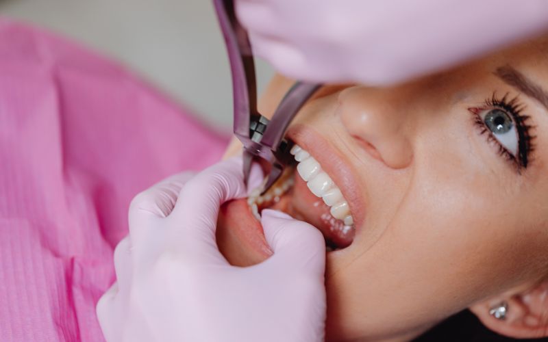 Tooth Extraction vs Saving a Tooth: Which Is Better?