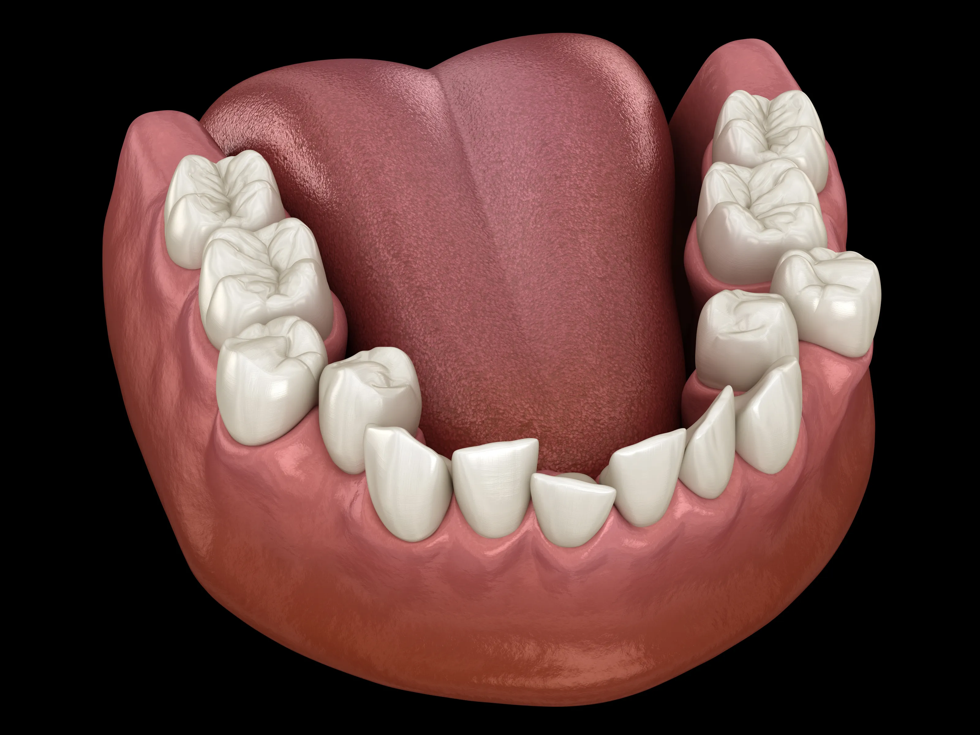 Patient dental consultation at Canarsie Dental Specialist