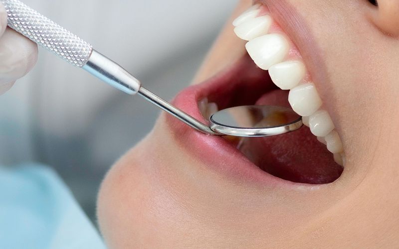 Wisdom Tooth Removal: When You Need an Oral Surgeon Instead of a General Dentist