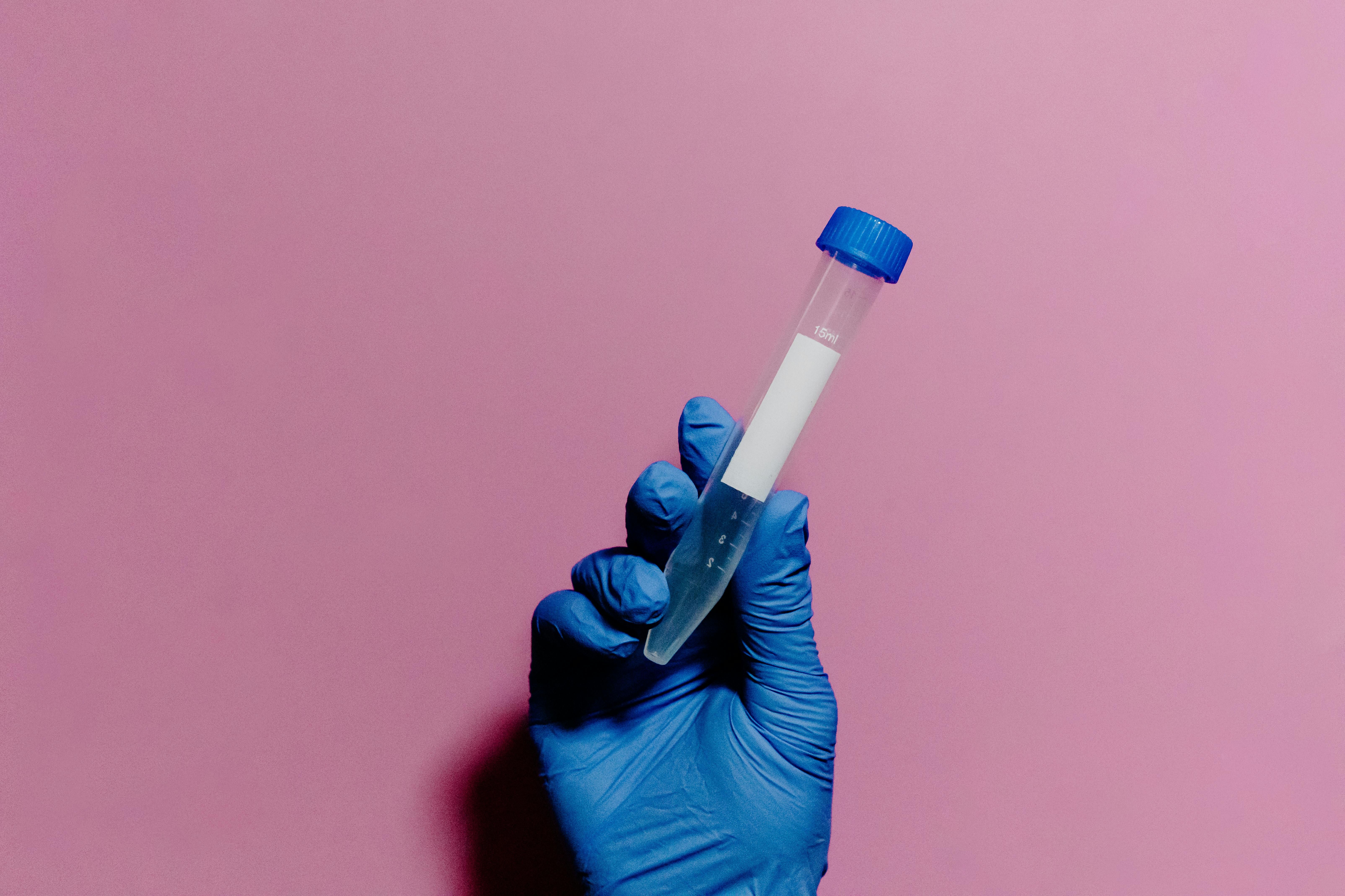 How NHS Monitoring Differs From Private Testing