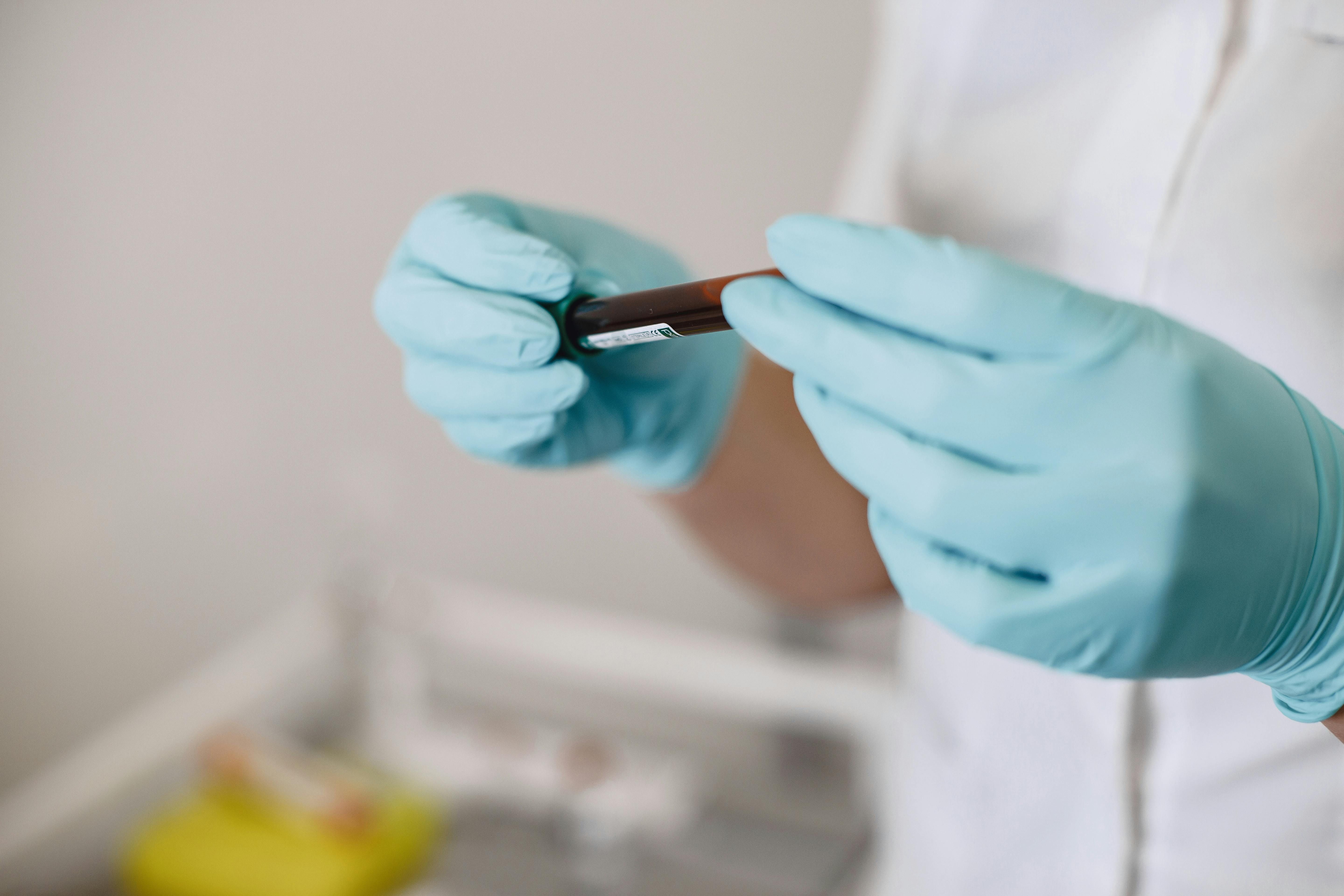 Why One Blood Test Rarely Tells the Full Story