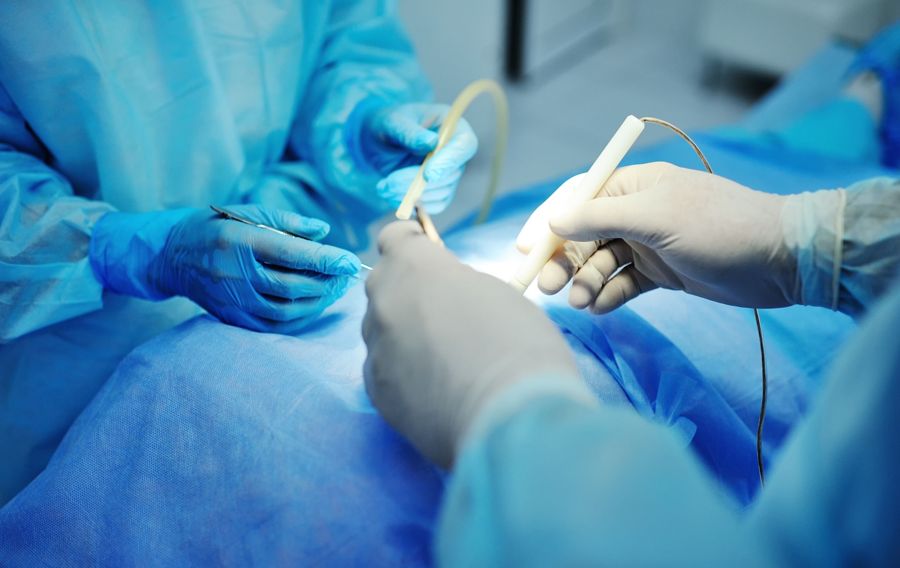 Hemorrhoid Treatment Options Explained
