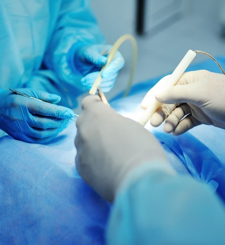 Hemorrhoid Treatment Options Explained