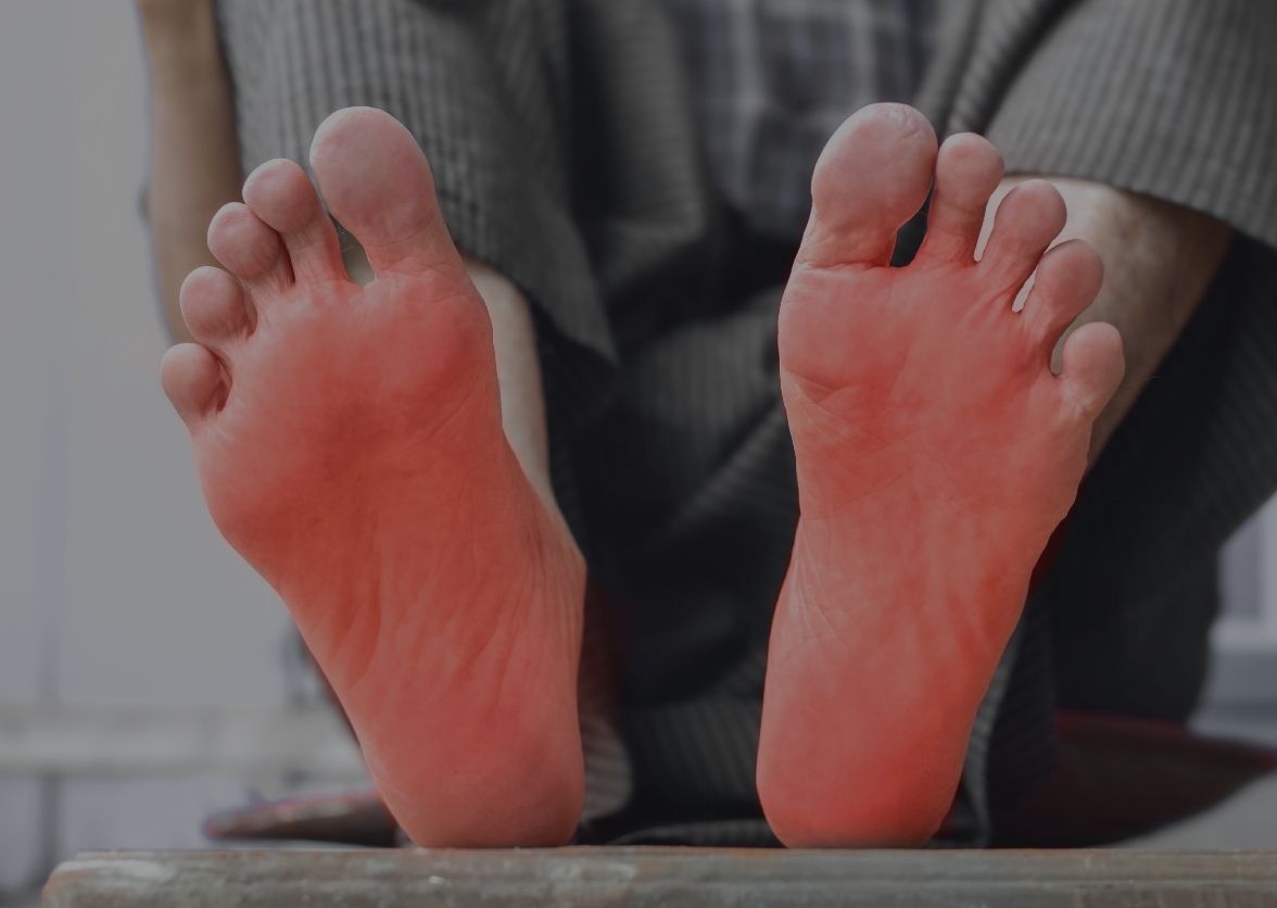 Burning Sensation in Feet: Causes and When to Worry