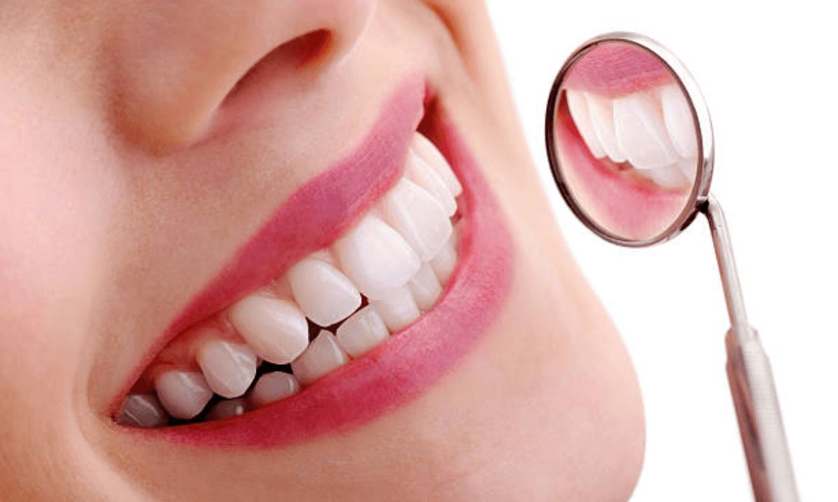 Smile Designing