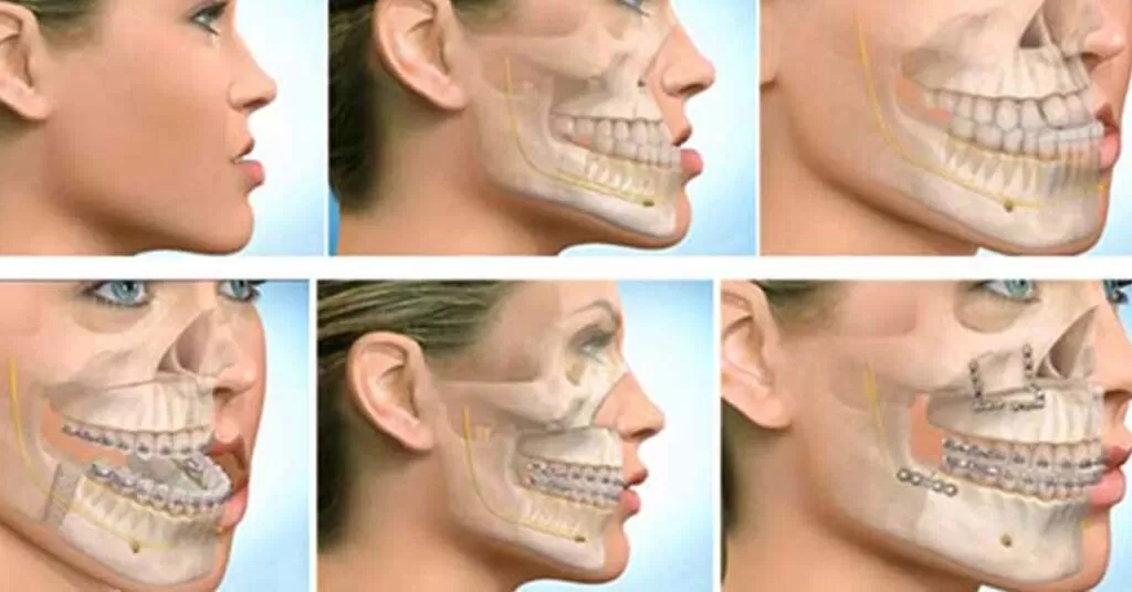Maxillofacial image
