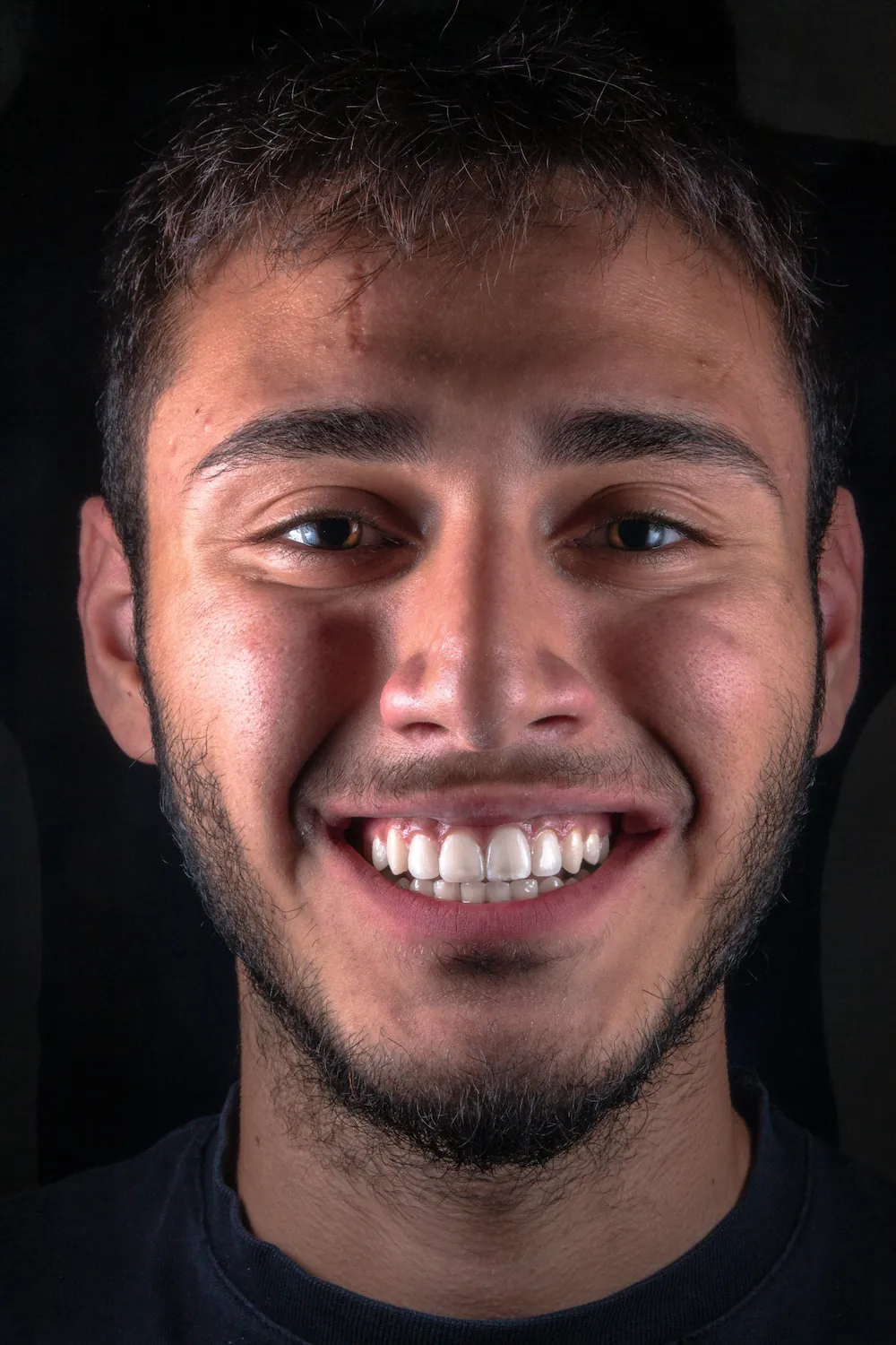 Smiling patient portrait after treatment