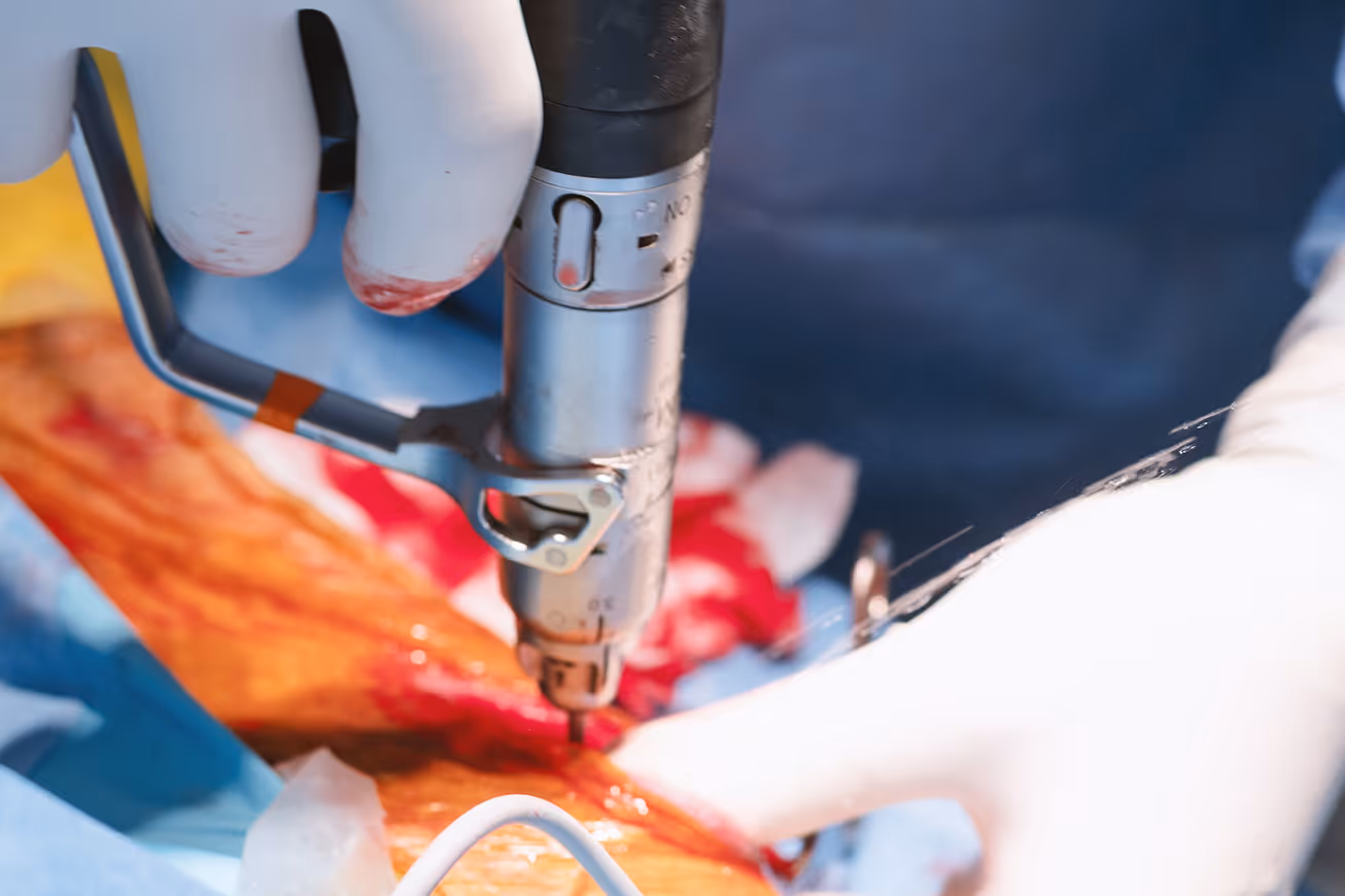Close-up of a veterinary surgeon using a specialized surgical bone drill during a complex pet orthopedic operation.