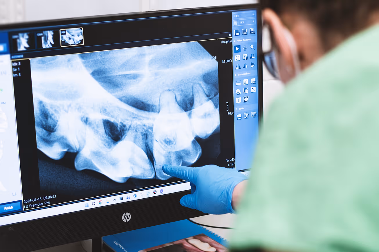 Close-up of a veterinary dentist examining a digital dental X-ray of a dog's teeth on a monitor.