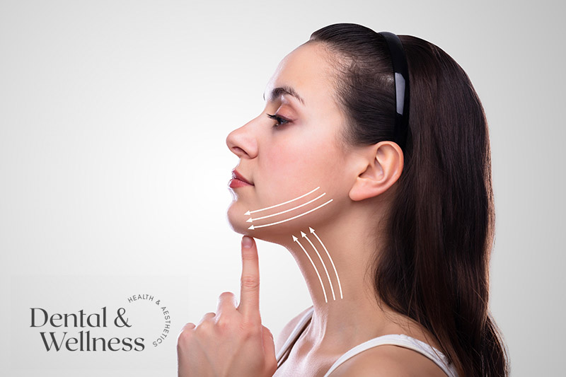 Woman in profile with lines drawn along her lifted jawline — neck muscle-relaxing treatment for pain