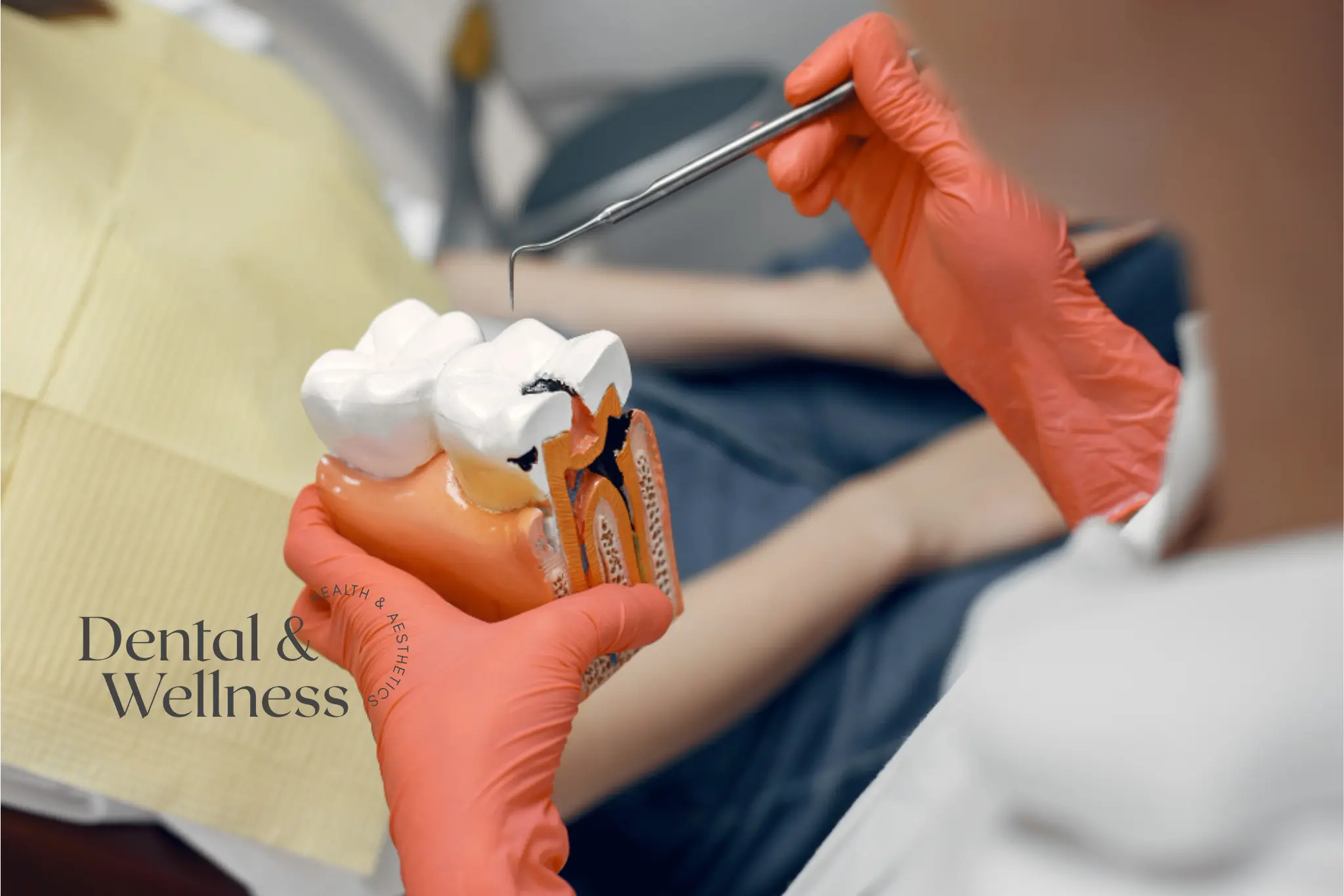 Root canal treatment time: gloved hands pointing a dental probe at a cross-section tooth model