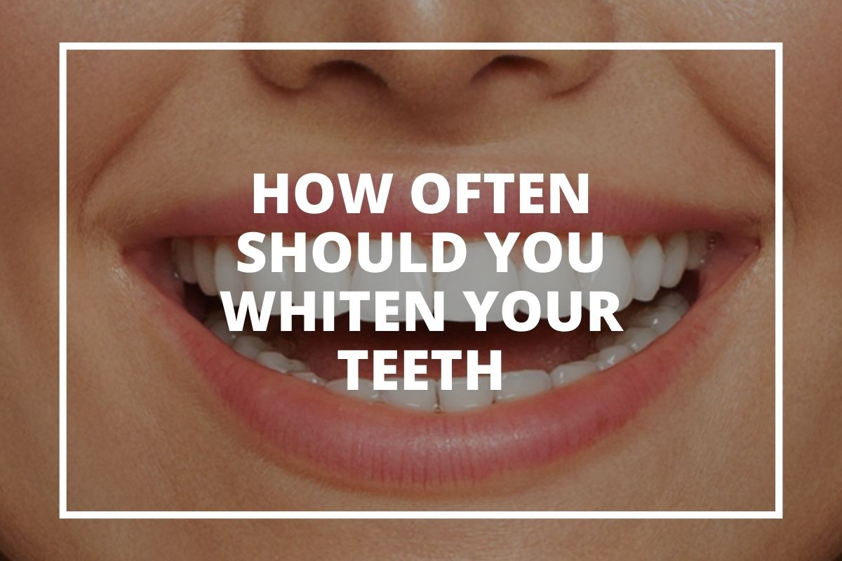 Graphic reading 'How often should you whiten your teeth' over a close-up of a smile