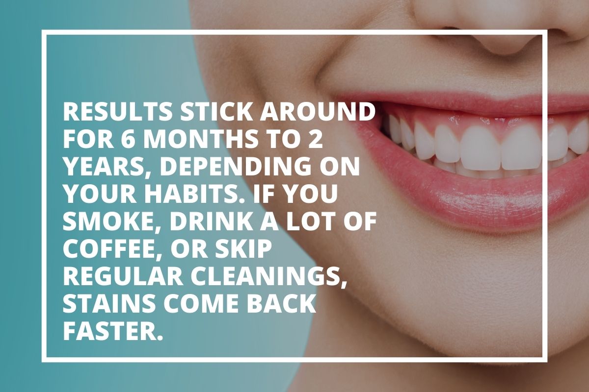 Graphic explaining that whitening results last 6 months to 2 years depending on habits such as smoking and coffee