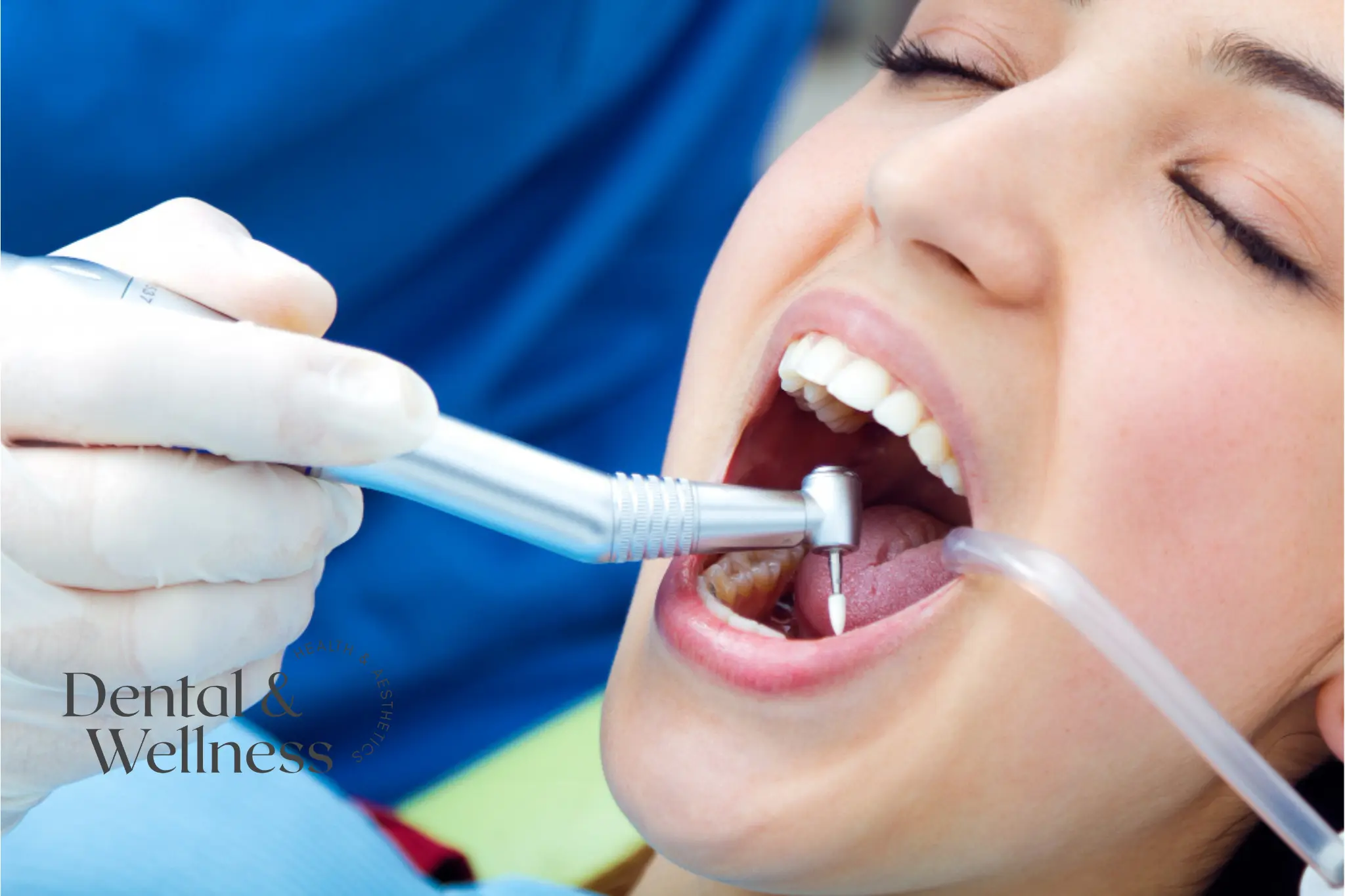 Close-up of a dentist drilling a back tooth with suction in place