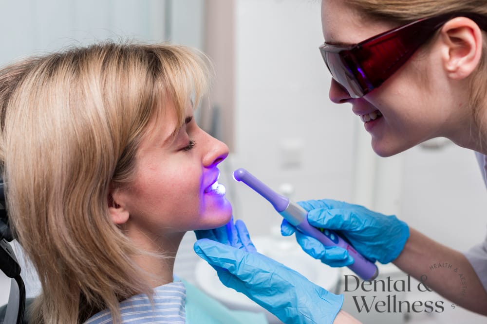 Dentist in protective glasses using a curing light on a patient's teeth — teeth stain removal