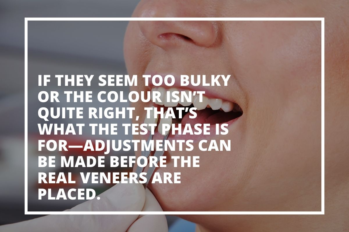 Graphic explaining that temporary veneers let you adjust shape and colour before the final veneers are placed