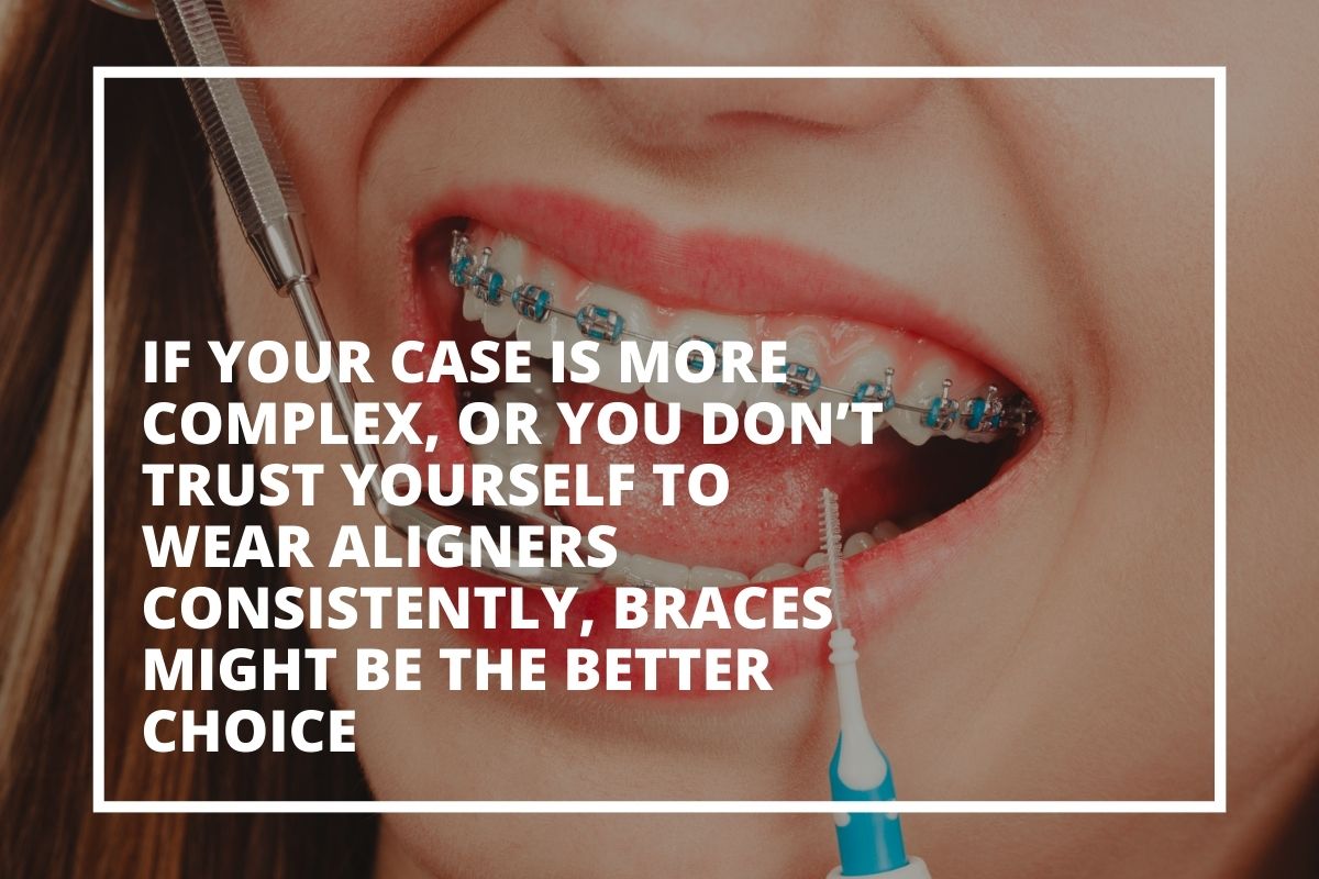 Graphic explaining that braces may be the better choice for complex cases or if aligner wear is a concern