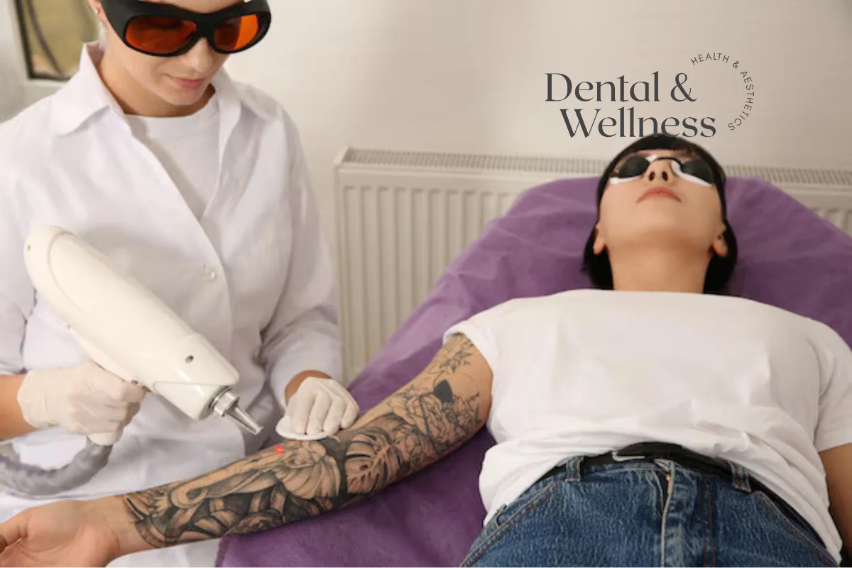 Laser tattoo removal: clinician in protective glasses treating a patient's arm tattoo with a laser