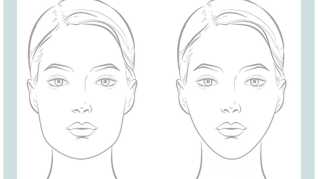 Line drawing comparing a wider jawline with a slimmer jawline