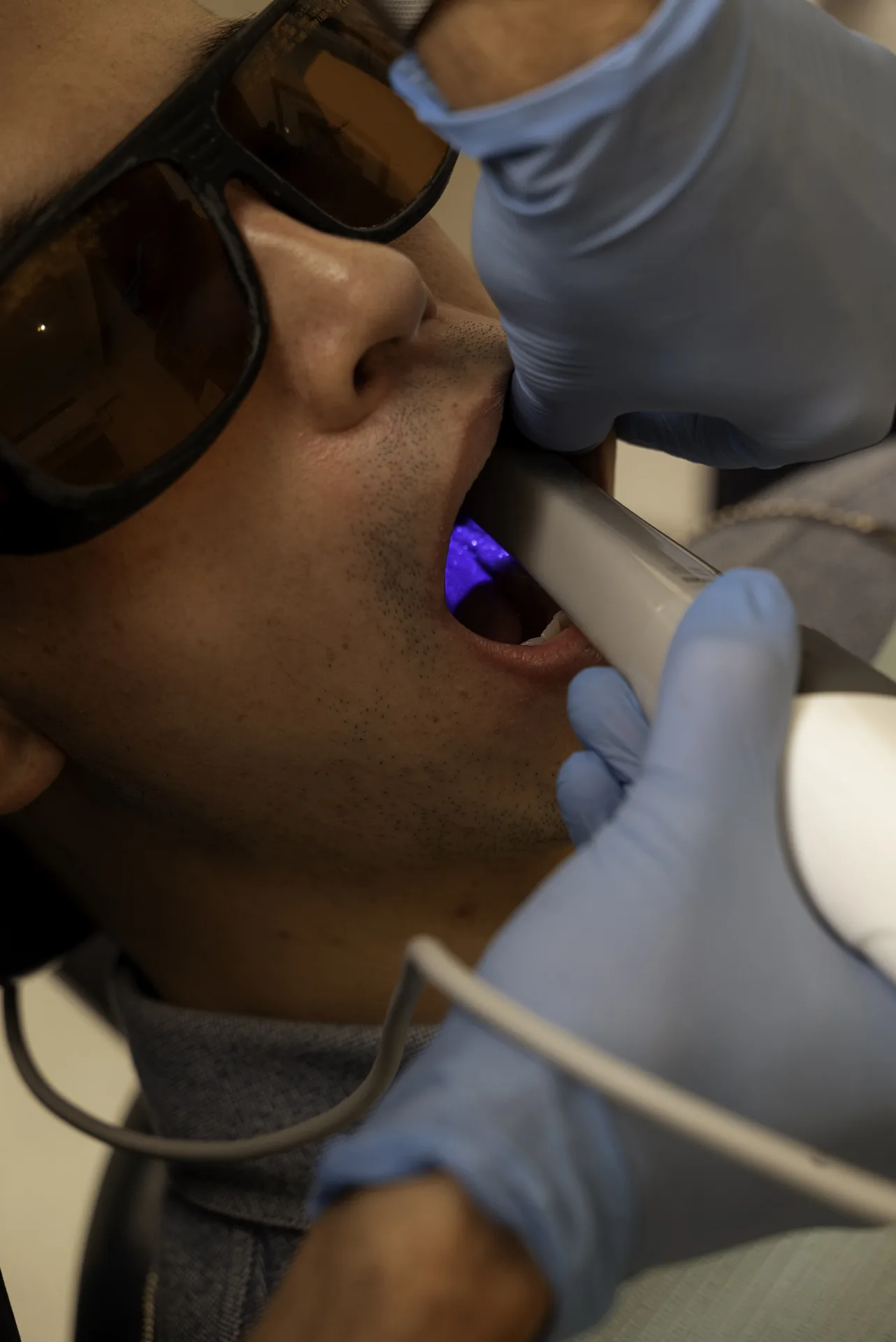 Patient in protective glasses having a curing light used on his teeth — bone grafting for dental implants