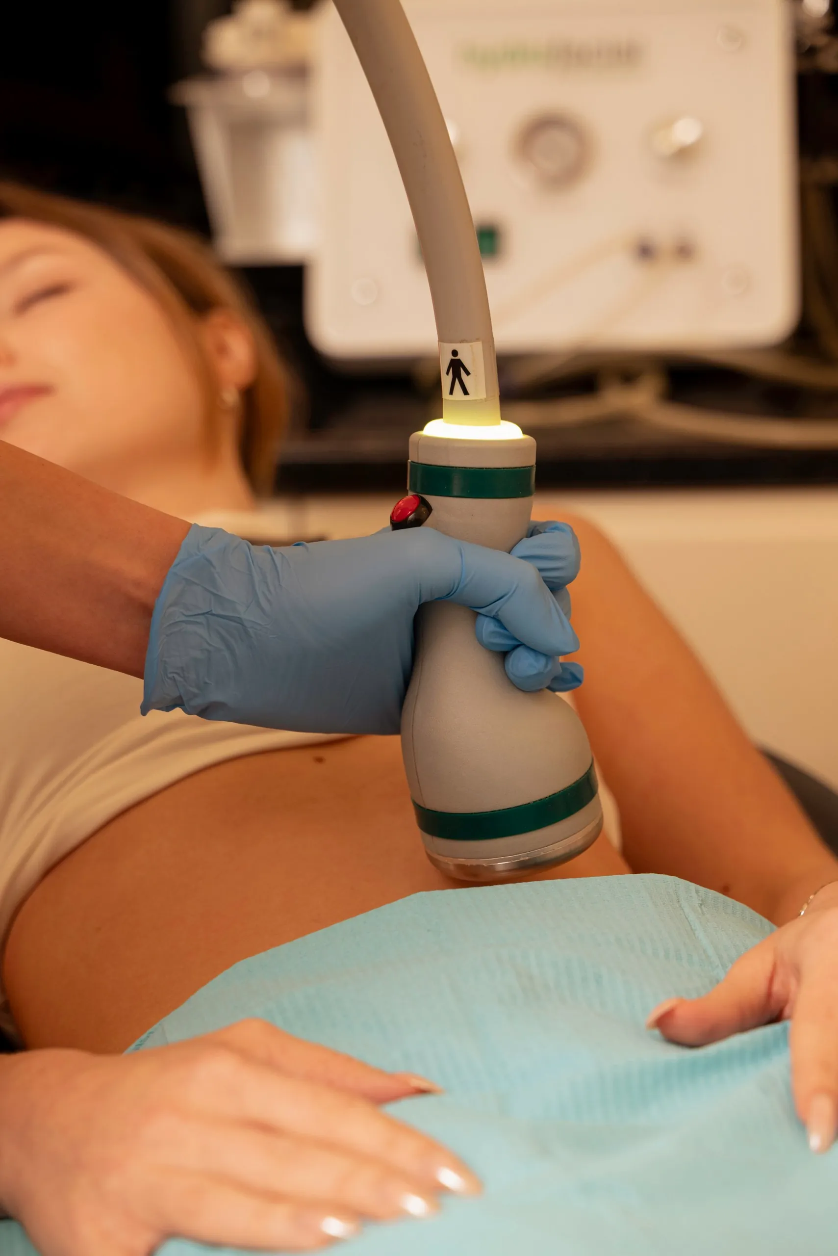 Non-surgical fat removal in Islington, London: close-up of an Onda handpiece on a patient's abdomen