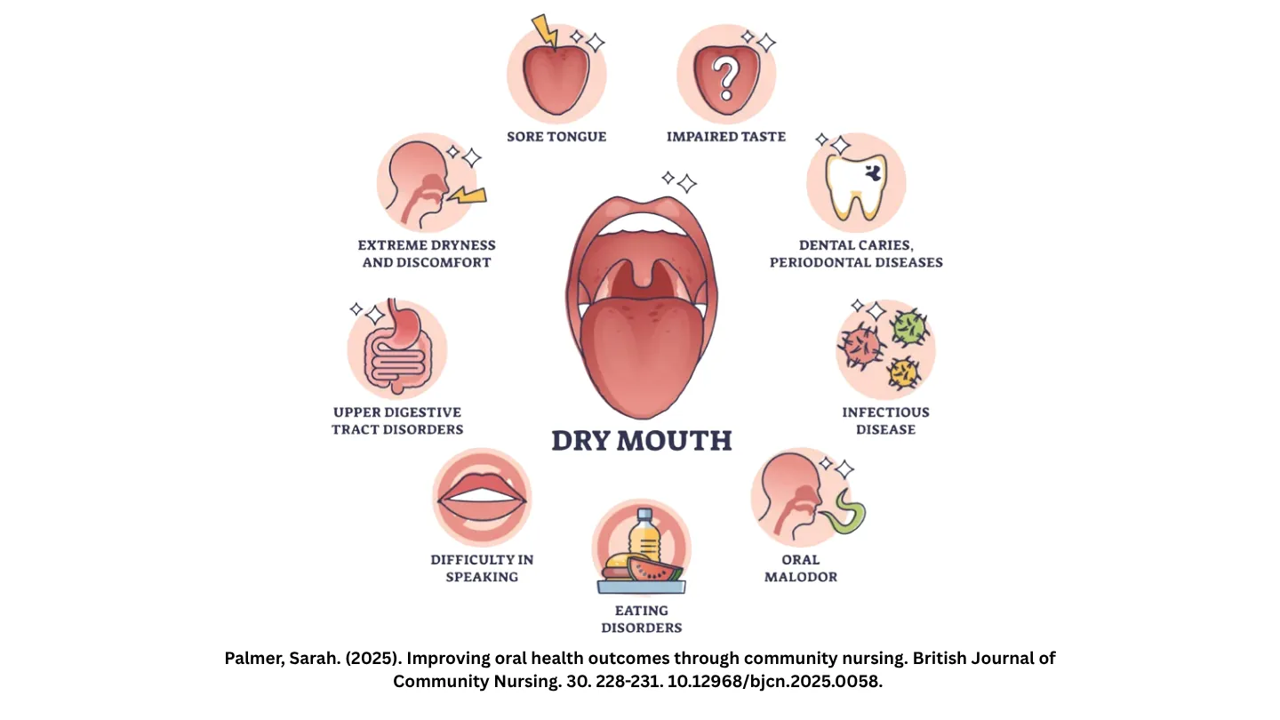 Infographic of dry mouth effects, from sore tongue and altered taste to tooth decay and difficulty eating