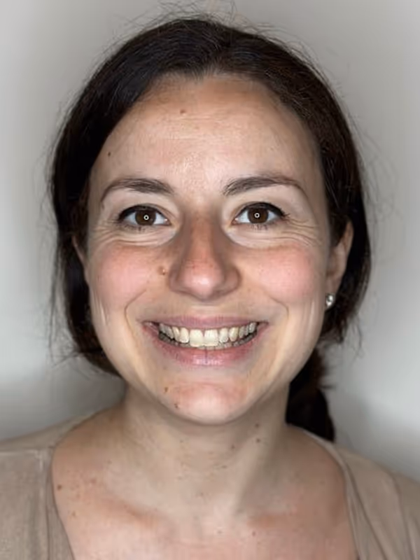 Before Invisalign at Dental & Wellness London, Islington